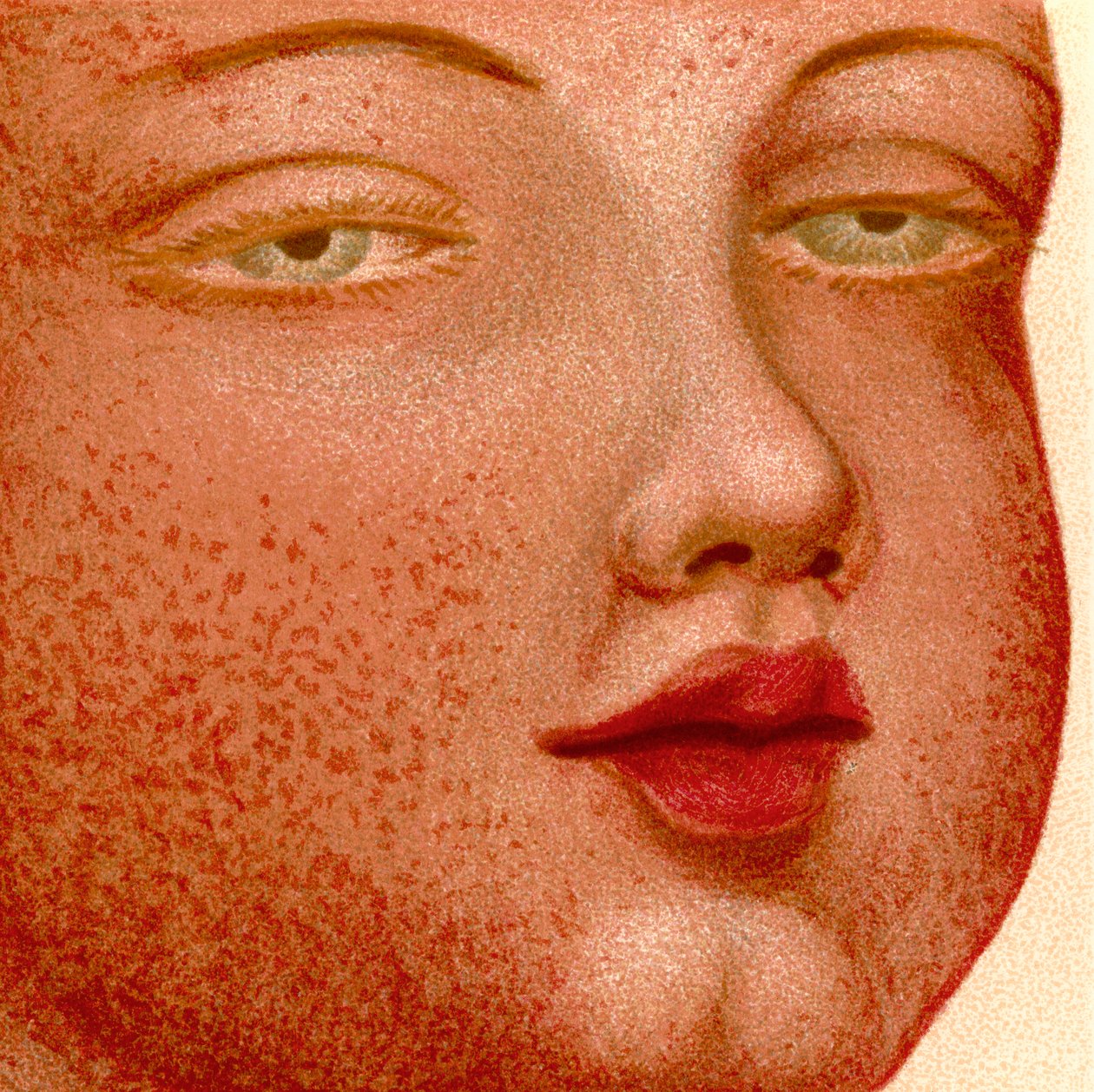 Eruptive feber: Scarlatina eller skarlagensfeber av Unknown artist