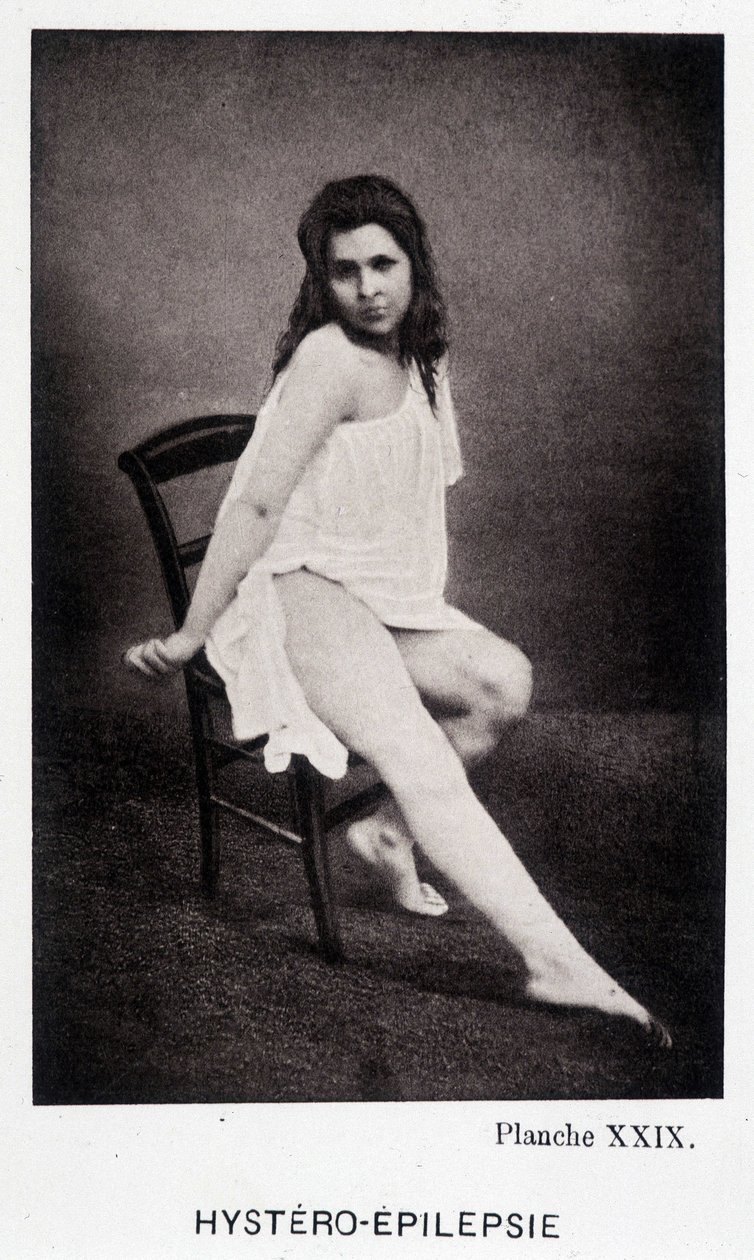 Hystero Epilepsie - Contracture in "" Fotografisk ikonografi av Salpétrière: service of Mr. Charcot" av Paul Regnard og Bourneville av Unknown artist