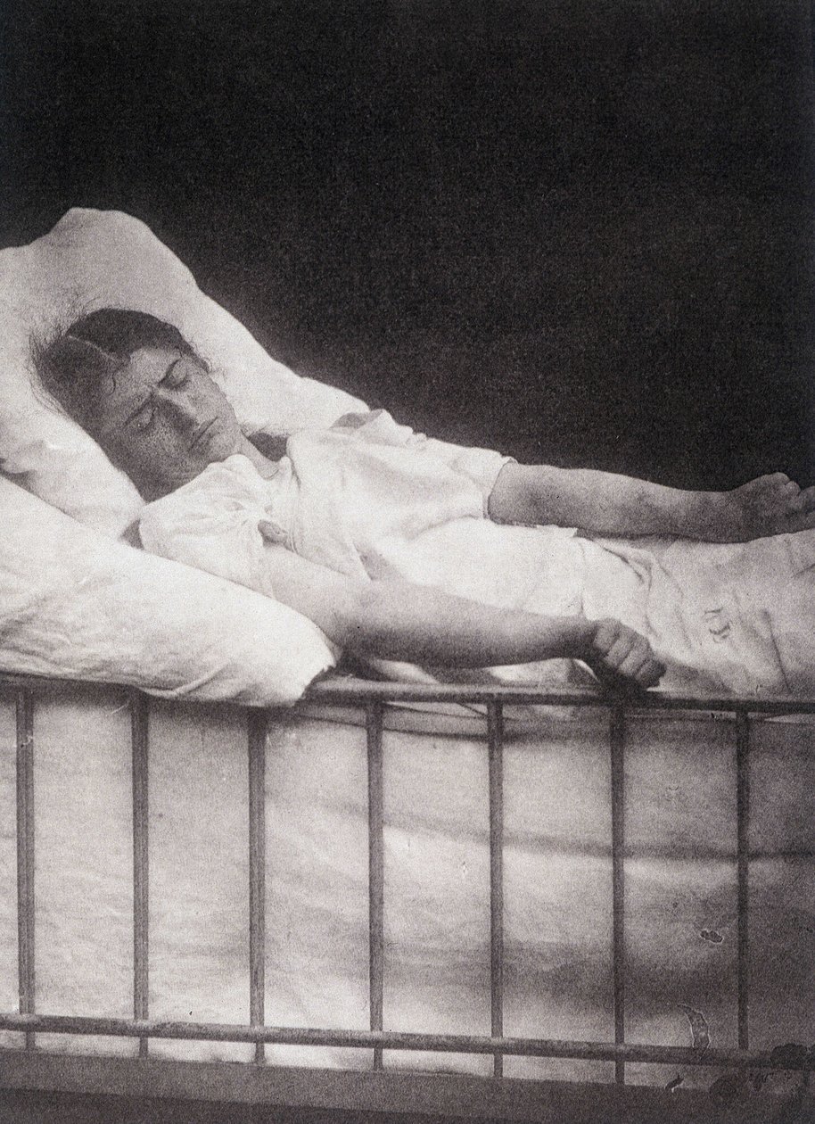 Hystero Epilepsie - Stivkrampeangrep i "" Fotografisk ikonografi av Salpétrière: service of Mr. Charcot"" av Paul Regnard og Bourneville av Unknown artist