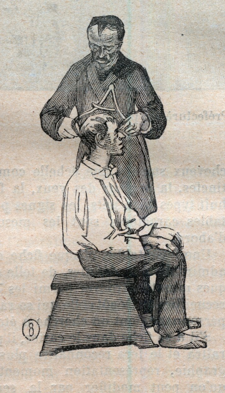 Rettsantropometri eller bertillonnage, metode av Alphonse Bertillon (1853-1914): måling av den tverrgående diameteren til hodeskallen - gravering i "" La Science francaise" av Unknown artist