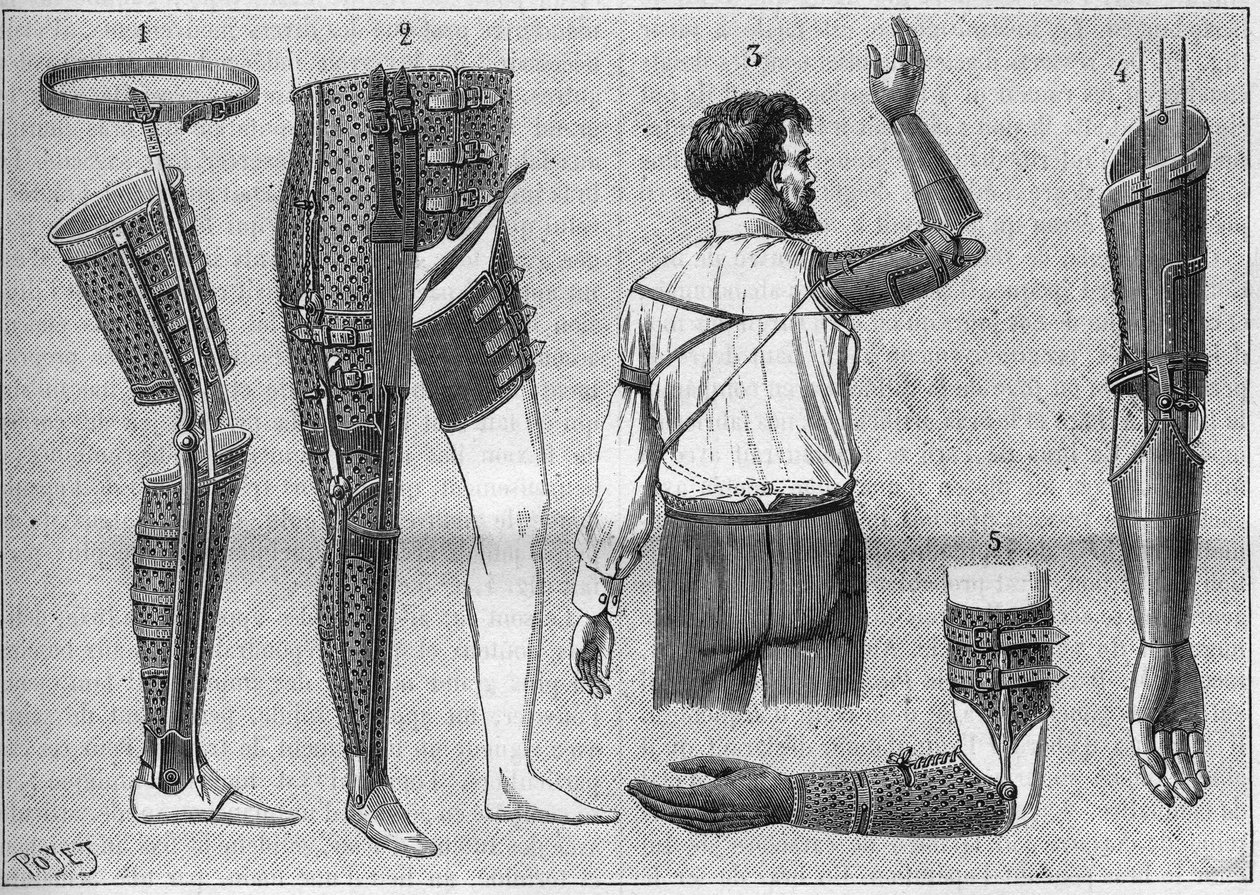 Modern apparatus for amputes. 1) artificial leg with belt, 2) apparatus for desarticules the thigh, 3 and 4 arificial arms invented and built by M.L Matthieu for the late Roger, 5) artificial arm with hand, thumb and index finger. in “La nature” of 1888. av Unknown artist