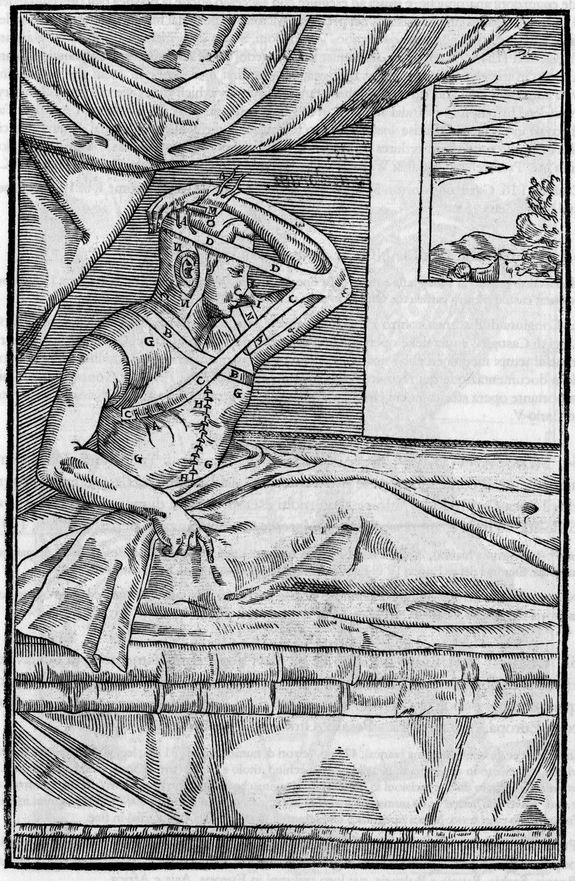 Nesekirurgi: Rekonstruktiv kirurgi på nesen i “De curtorum chirurgia per insitionem””. Venezia av Unknown artist