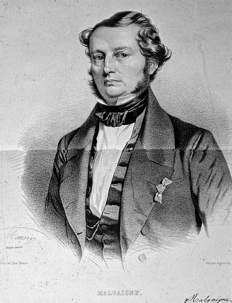 Portrett av Joseph François Malgaigne (1806-1865) av Unknown artist