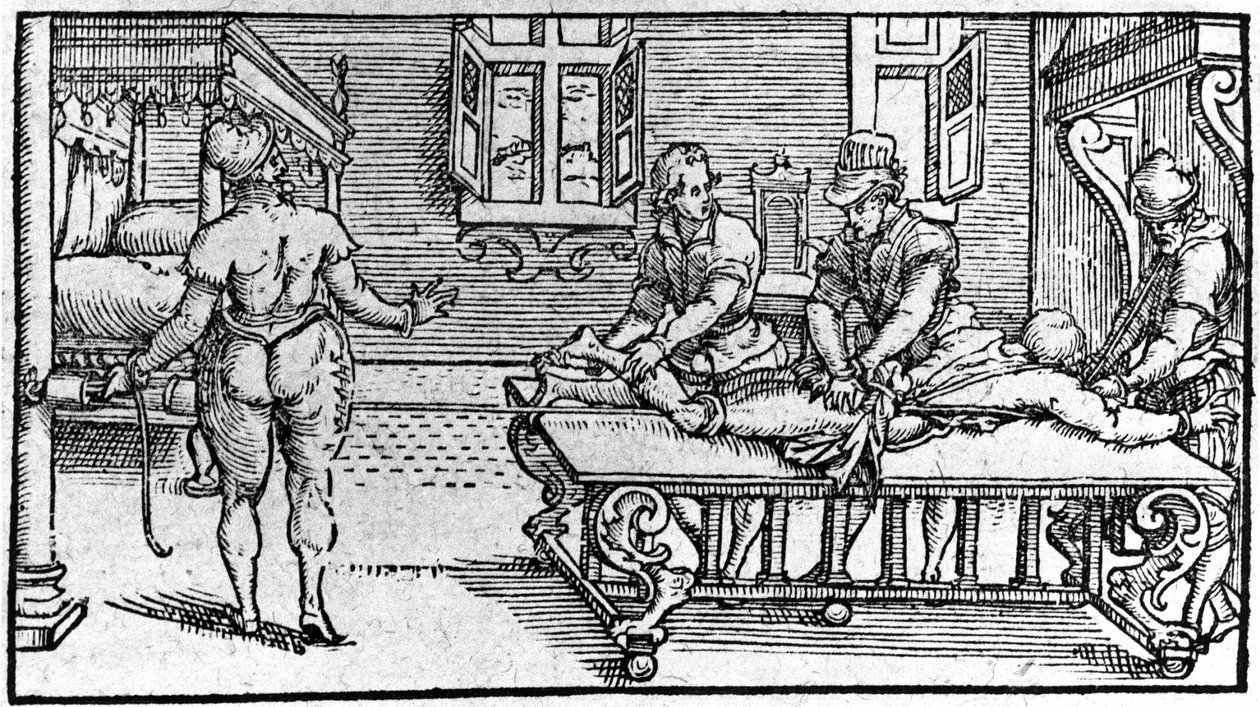 Reduksjon av en dislokasjon, -i "Medical Treatise" av Ambroise Paré, rundt 1560. av Unknown artist
