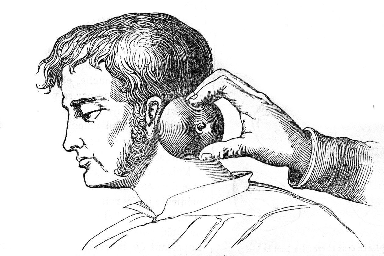 Saignee locales - application of leeches with an apple - engraving in “La Santo Universelle - Medical Guide for Families”” 1852 av Unknown artist