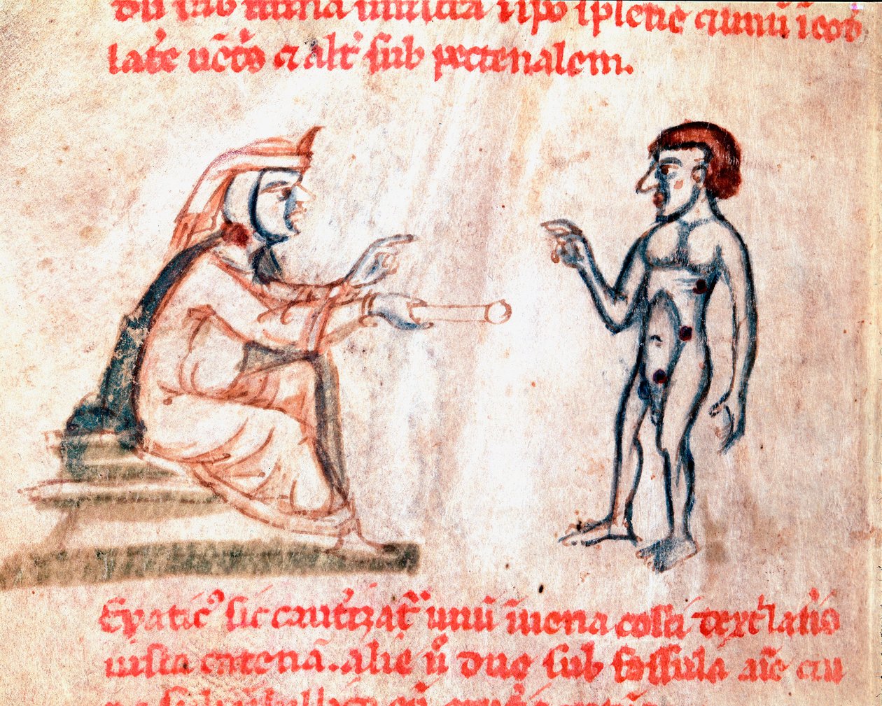 Legen brenner pasienten på smertefulle områder med varme strykejern Miniatyr fra manuskriptet " "De Medicina cauteriorum secundum Brunum, Rugerius et Rolthe" 1200-tallets Paris, BN av Unknown artist