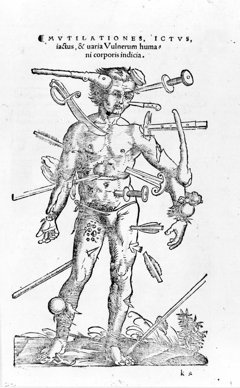 Alle slags traumatiske krigsskader. Det 16. århundre av Unknown artist