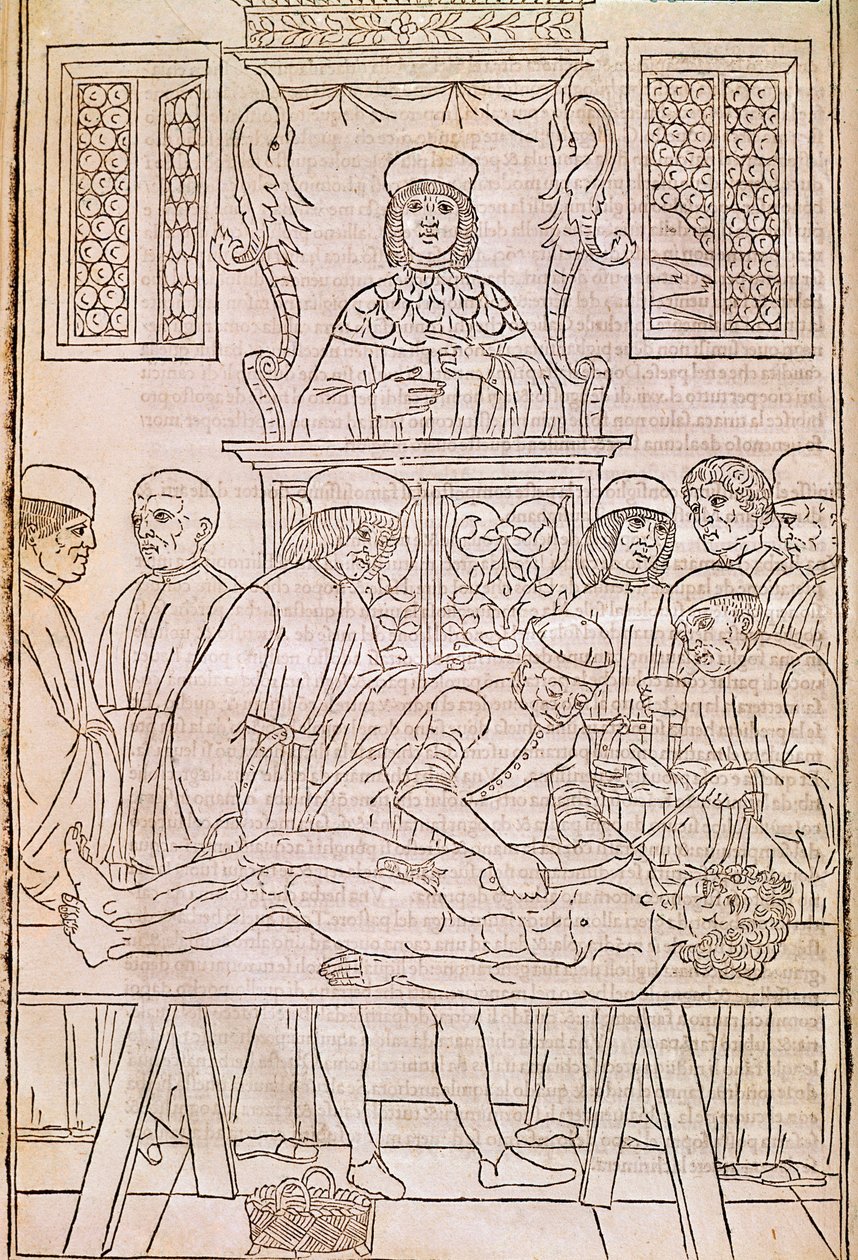 Autopsi. Kodice. Kroppen til en død person dissekeres av leger for en anatomistudie. “” Fascicula Medicinae””. Kodeks av en leges fascikel av Johannes Kethan av Unknown artist
