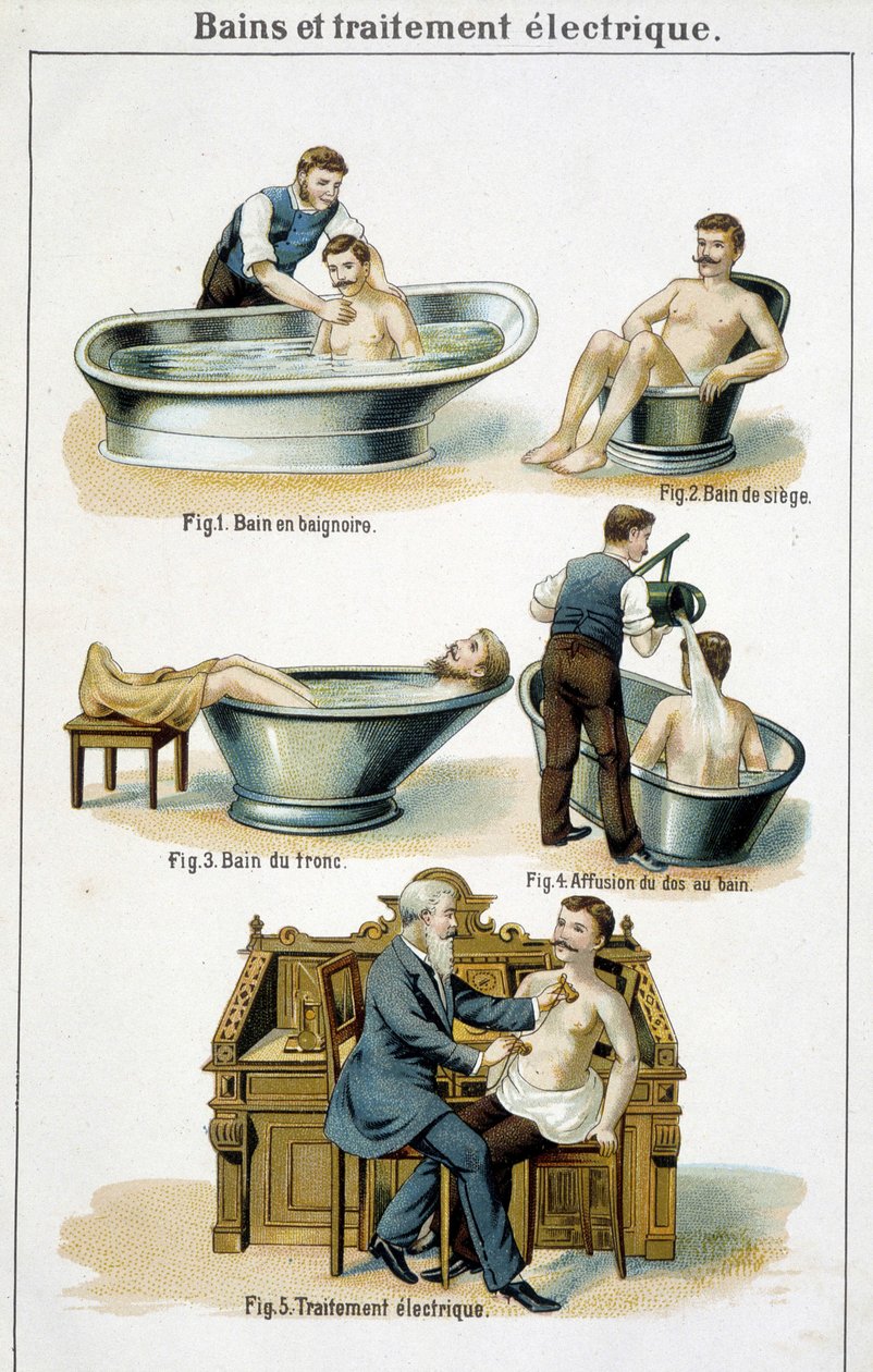 Bad og elektrisk behandling: 1) Badekar, 2) Setebadekar, 3) Bagasjeromsbad, 4) Tilbake til badekar, 5) Elektrisk behandling - i "Bilz, Natural Medication", slutten av 1800-tallet av Unknown artist
