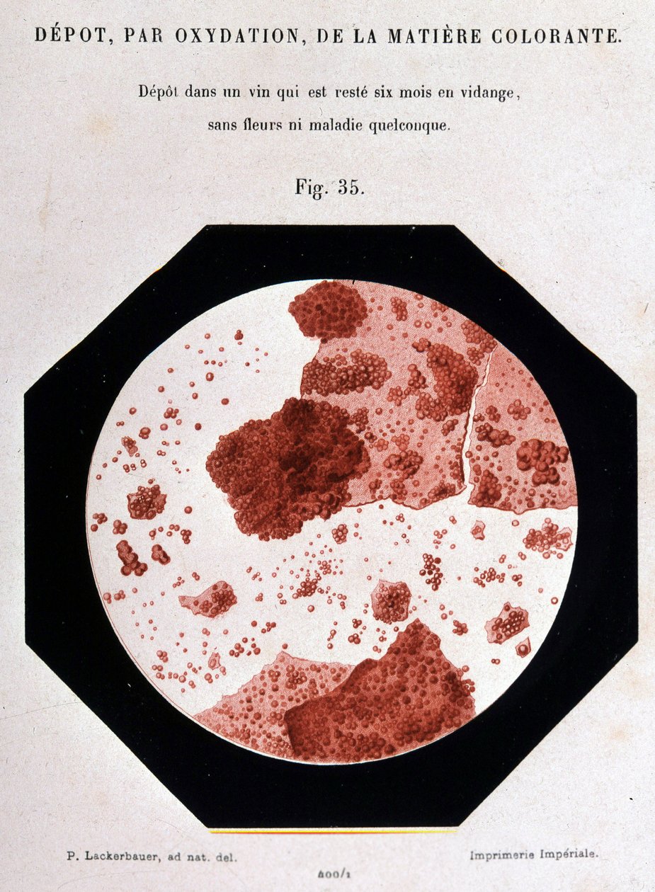 Avsetning, ved oksidasjon, av fargestoffet: avsetning i et sikte som har vært tømt i seks måneder uten blomster eller sykdom. 400/1 mikroskopisk visning. Studie om vin 1866 av Pasteur. av Unknown artist