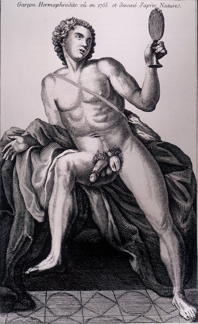 Hermaphrodite boy seen in 1755 and drawn from nature. av Unknown artist