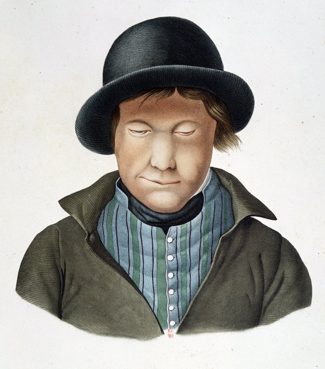 Spedalske av Island, rundt 1840, B.N. av Unknown artist