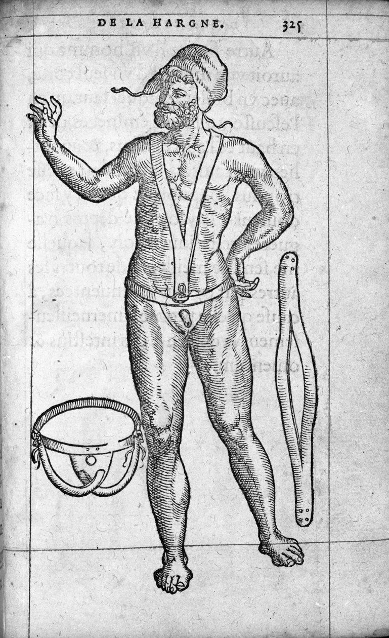 Medisin: et hernialbelte. Gravering fra "" De la hargne"" av den franske legen og kirurgen Ambroise Pare (1509-1590) 1500-tallet av Unknown artist