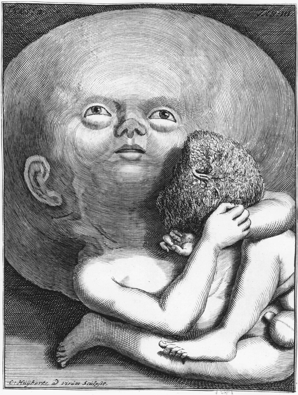 Monster: Child hydrocephalus anthropology - grave., a.n.d., sent på 1700-tallet av Unknown artist
