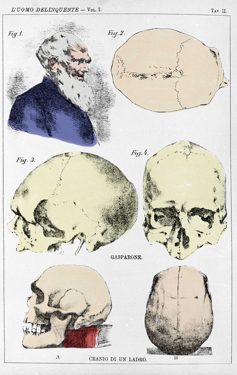 Studie om morfologien til en delinquant hodeskalle av den italienske kriminologen av Unknown artist