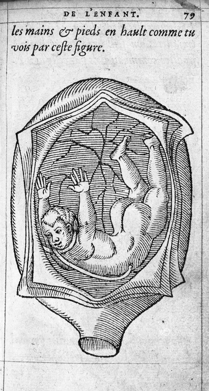 Posisjonen til fosteret i livmoren under graviditet. Gravering fra "" De la generation des enfants"" av den franske legen og kirurgen Ambroise Pare (1509-1590) 1500-tallet av Unknown artist