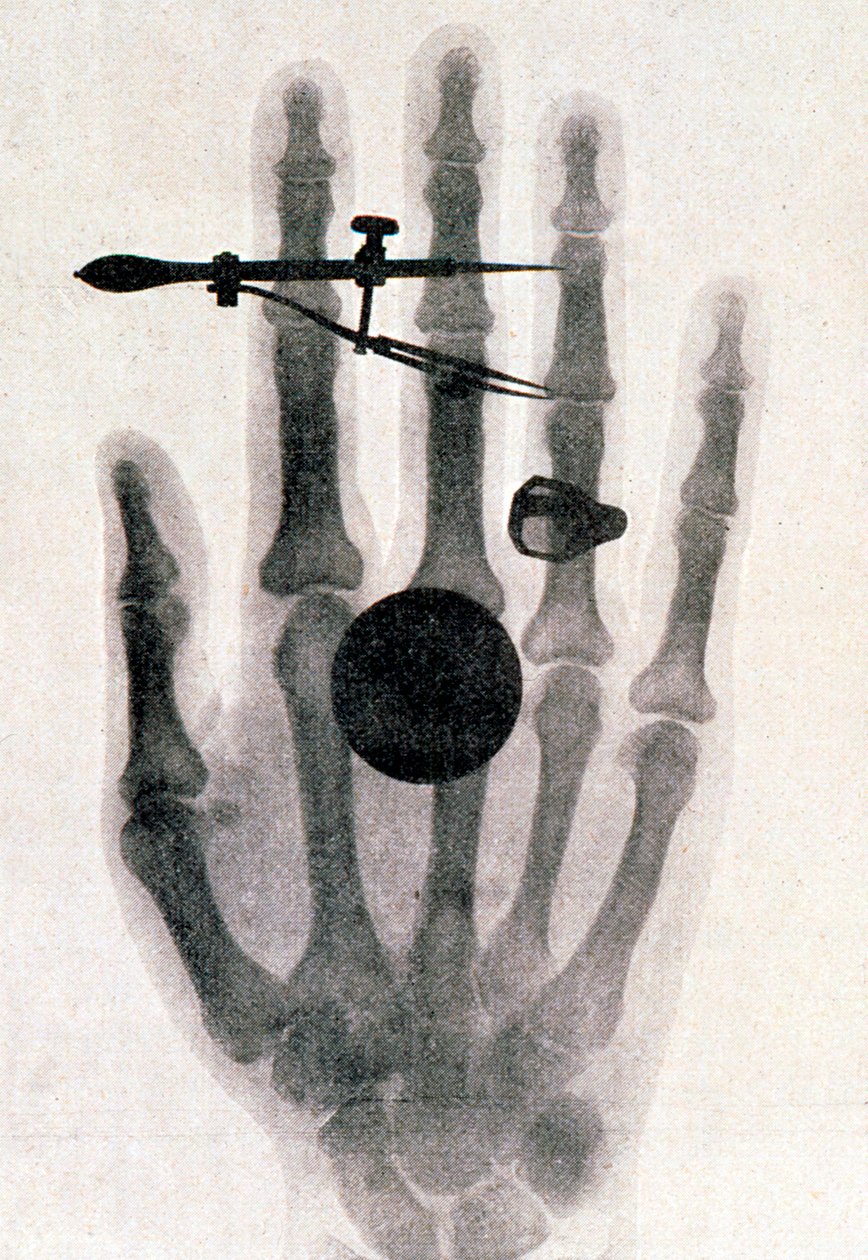 Wilhelm Roentgens røntgenfotografi av sin kones hånd, 1896 av Wilhelm Conrad Rontgen