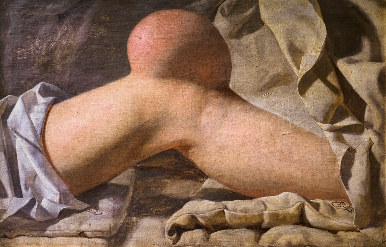 En hevelse i Regio Patellaris [kneet] av Wilhelm Ferdinand Bendz