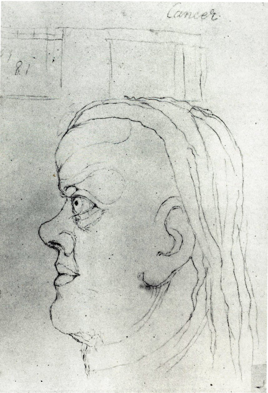 Kreftsjef av William Blake