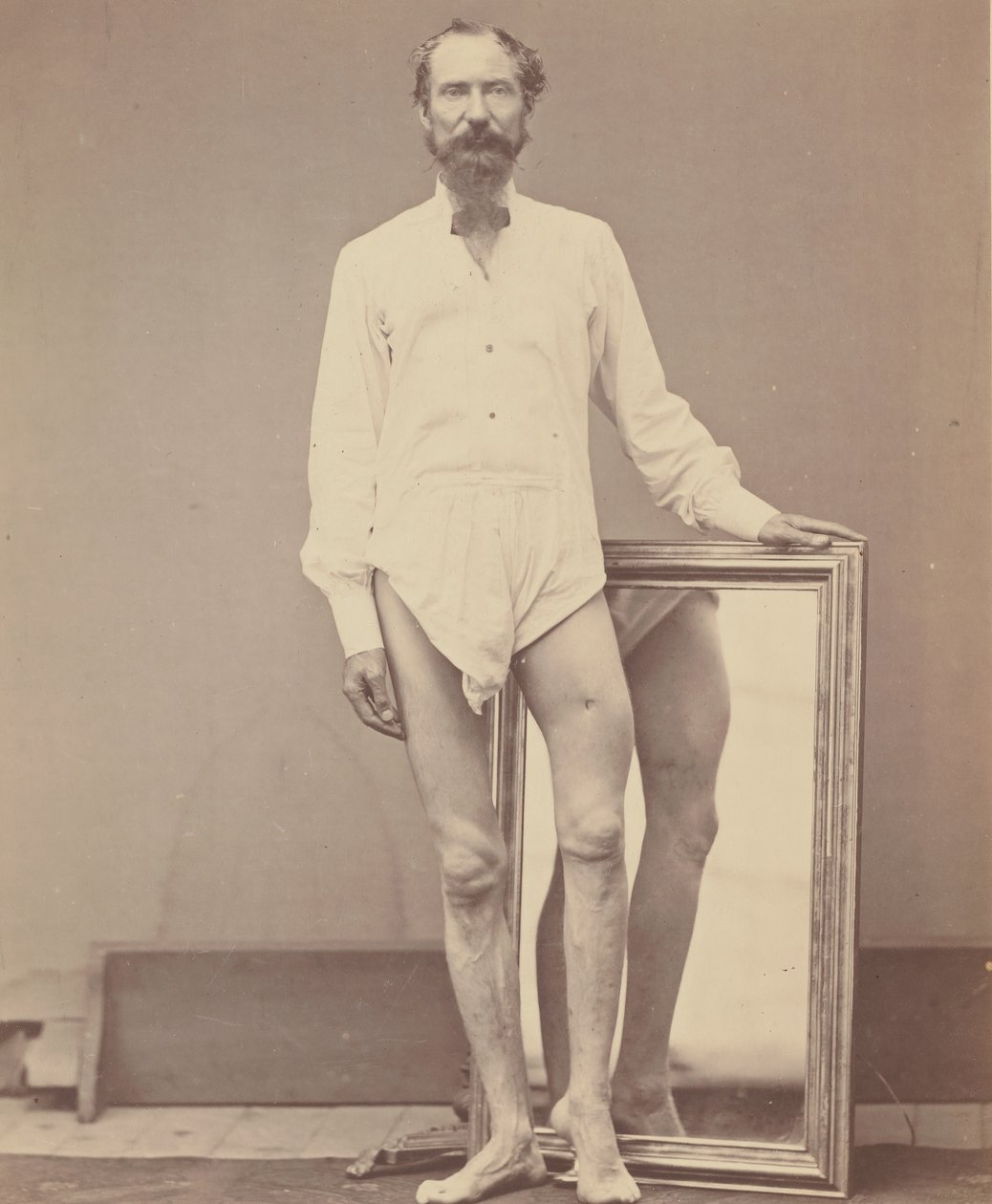Gunshot Wound of Middle Third of Left Femur, 1865-67.    1137913   no       norwegian Successfully Translated  Original: Bjernede kirke Translat: Bjernede kirke 1281142 no norwegian Successfully Translated Original: The Waterproof Coat of General Moltke Tr av William H. Bell