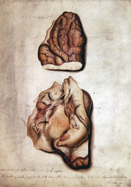 Study of Brain III, ca. 1850 (akvarell på papir) av William Lover
