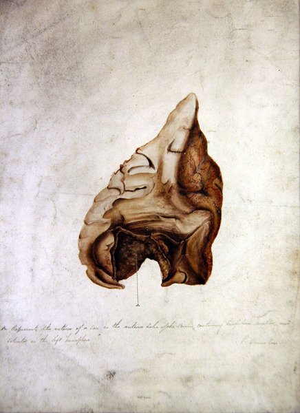 Study of Brain I, ca. 1850 (akvarell på papir) av William Lover