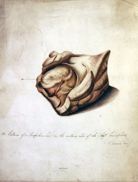 Study of the Brain II, ca. 1850 (akvarell på papir) av William Lover