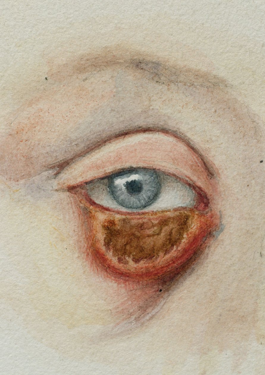 Øyne av Frederick (attr. to) Barnard