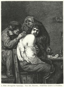 Ryggoperasjonen av Adriaen (after) Brouwer