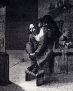 Den kirurgiske operasjonen Gravering etter et maleri av Adrien Brauwer (gjort 1608) 1600-tallet av Adriaen (after) Brouwer