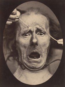 Electro-Physiologie, figur 64, 1854-56, trykt 1862.