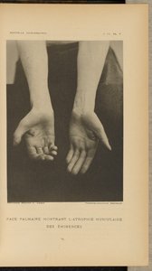  av Albert Londe