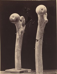 Prøver av skuddbrudd i lårbeinet av American 19th Century