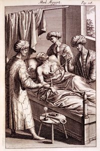 Illustrasjon av moxibustion fra Medicina Aegyptorum av Prospero Alpinus, 1745 av American School