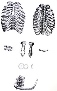 Platene fra den første boken til De Humani Corporis Fabrica av Andreas Vesalius