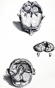 Platene fra den syvende boken til De Humani Corporis Fabrica av Andreas Vesalius