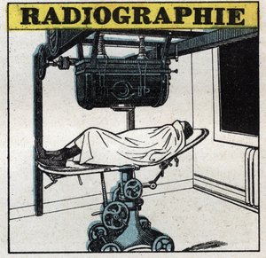 Røntgen: Røntgenapparat. Anonym illustrasjon fra 1925. Privat samling. av Anonymous Anonymous