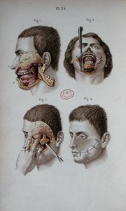 Anatomisk plate av overkjeven av C and Huette E. Bernard