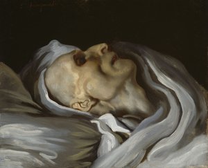 Théodore Géricault på hans dødsleie