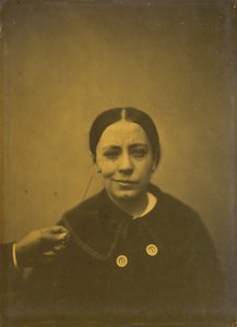 Litt senking av munnvinkelen på grunn av depresjon venstre, falsk latter høyre, 1854-185