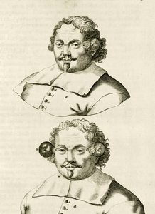 Et eksempel på kopping, fra The Practice of Medicine av Frederik Dekkers, 1694 av Dutch School