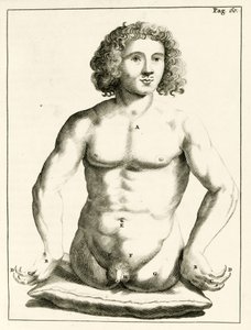 Eksempel på medfødte misdannelser av Frederik Dekkers, 1694 av Dutch School