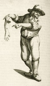Fjerning av død hud med pustler, fra Practical Exercises in Medical Methods av Frederik Dekkers, 1694 av Dutch School