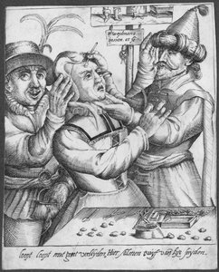 Trepanning, gravert av H. Weydmans (1500-tallet) av Dutch School