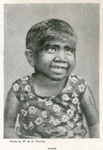 Krao, The Missing Link, utstilt på Aquarium, Westminster, London, i 1887 av English Photographer