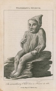 Et ekstraordinært barn født i Frankrike i 1683 av English School