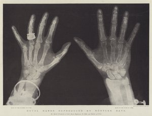 Royal Hands gjengitt av Rontgen Rays (gravering) av English School