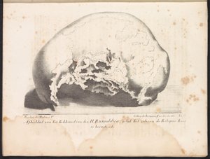 Skull of Saint Rumbold, 1825 Bilde av bekkenet til H. Rumoldus slik det er i Reliquie-Kas (tittel på objekt)