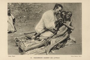 Misjonær som tar seg av spedalske av French Photographer