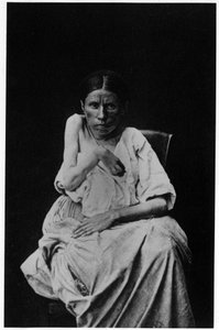 Fotografi av en pasient som lider av hemiplegisk epilepsi, -i "" fotografisk ikonografi av Salpetrière, Bourneville og P. Regnard, Paris av French Photographer